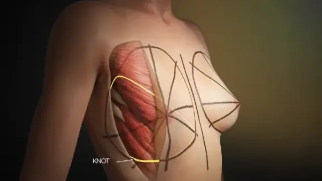 Film d'animation 3D — Dr Abboud