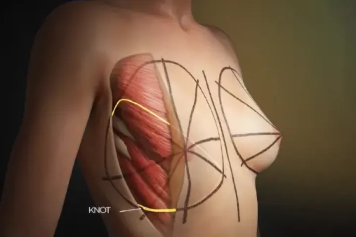 Animations 3D Médicale