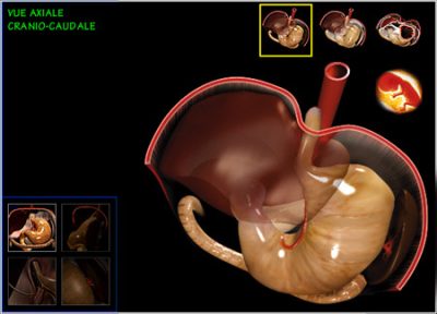chirurgie digestives vue axiale